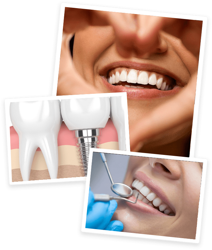 tandarts antwerpen